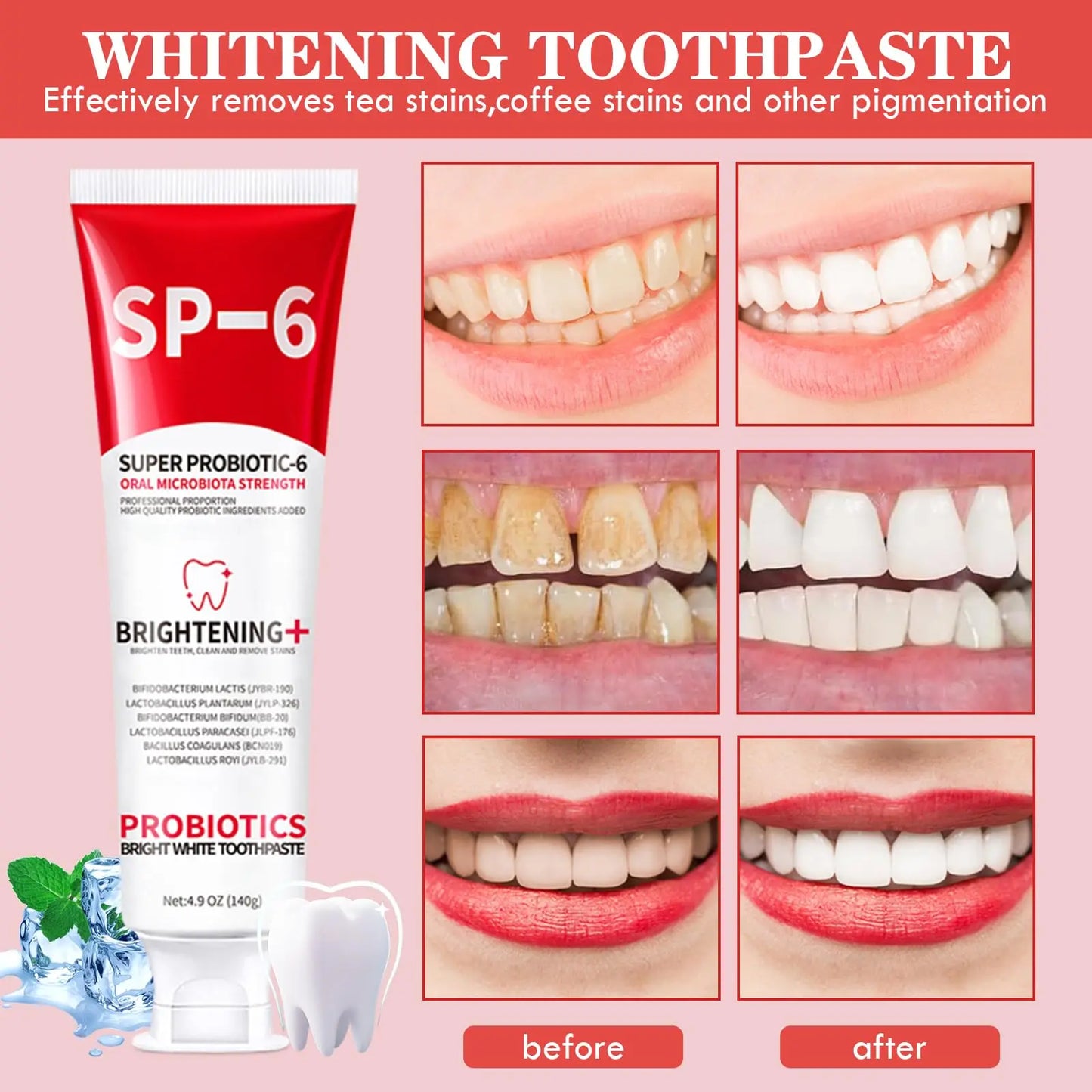 SP6 Probiotics Whitening Toothpaste